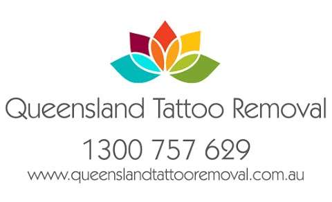 Photo: Queensland Tattoo Removal